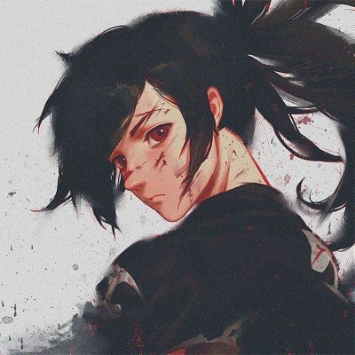 爱德华兹受伤